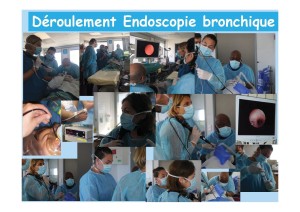 endoscopie-bronchique-1