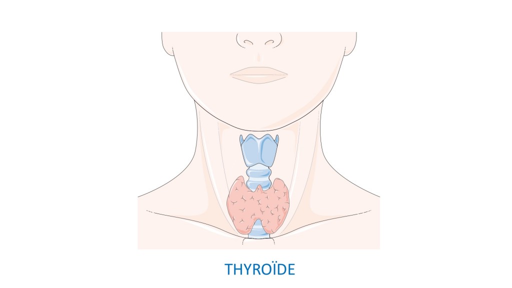 Diapositive - thyroide grande