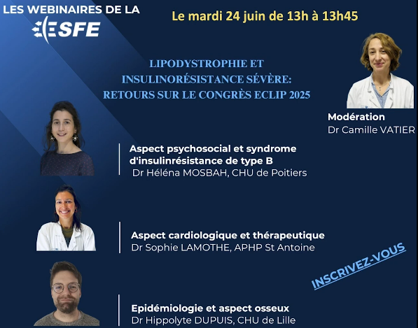 Webinaire SFE 2025
