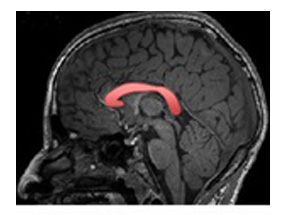 neuropediatrie